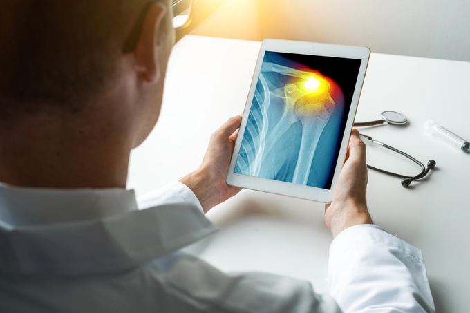 Comprehensive osteoarticular evaluation at Renuvia